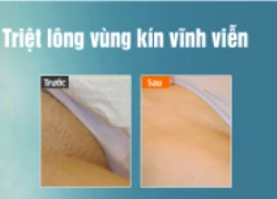 Làm thế nào để tẩy lông vĩnh viễn vùng nách và bikini?