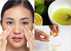 Tuyệt chiêu loại bỏ nám da nhanh chóng chỉ với... trứng gà