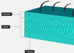 Vì sao nếp nhăn hình thành trên da?