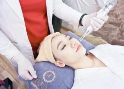 3 liệu pháp trị nám được yêu thích tại Ruco Spa