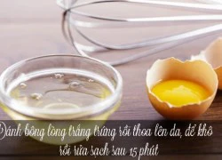 5 mẹo chữa bỏng nắng cực nhanh, cực hiệu quả