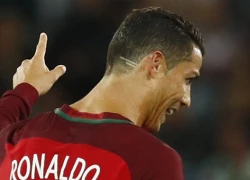 Hai đường cạo bí ẩn trên gáy C. Ronaldo