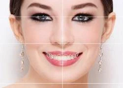 Răng đẹp với Veneer siêu mỏng không mài răng