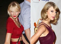 Taylor Swift bị nghi nâng cấp vòng một