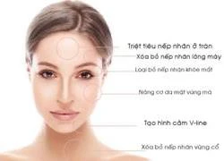 Căng da và tạo mặt V-line không xâm lấn