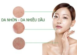 Da nhờn bóng, phải chăm sóc như thế nào để không nổi mụn?