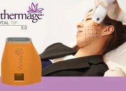 Giảm chảy xệ làn da nhờ công nghệ Thermage