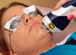 Laser trong thẩm mỹ: những hiểu biết cần thiết