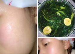 Mẹo xông mặt trị mụn bằng lá cây vườn