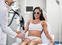 Mối nguy hại gây ung thư từ phương pháp triệt lông bằng tia laser