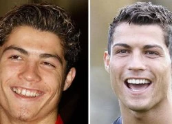 Ronaldo phải hút mỡ bụng để có thân hình săn chắc