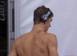 Giải đáp về những vết đỏ trên người kình ngư Mỹ Michael Phelps