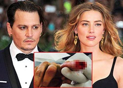 Johnny Depp cứa đứt ngón tay vì nghi vợ ngủ với chồng cũ Jolie