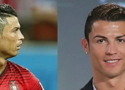 Ronaldo đứng trước nguy cơ bị &#8230; hói đầu