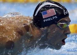 Truyền hình quốc gia Nga so sánh liệu pháp giác hơi của Phelps với doping