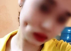 Hot girl Hà Nội biến dạng mặt sau khi cắt lúm đồng tiền