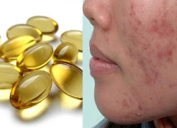 99% chị em sẽ mua Vitamin E ngay khi biết được những điều này