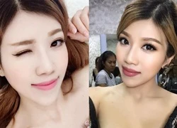 Trang Pháp nói gì khi vướng nghi vấn dao kéo giúp môi căng mọng?