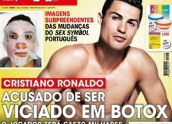 C. Ronaldo &#8216;nghiện&#8217; botox