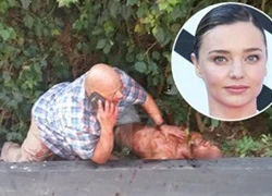 Kẻ đột nhập nhà Miranda Kerr máu me bê bết vì bị vệ sĩ bắn 4 phát