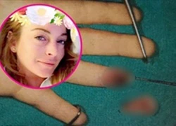 Lộ thêm ảnh về đầu ngón tay bị đứt lìa của Lindsay Lohan