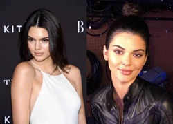 Rộ nghi vấn Kendall Jenner bắt chước em gái bơm môi