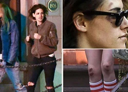 Kristen Stewart trông bầm dập khi đi chơi với người tình tin đồn