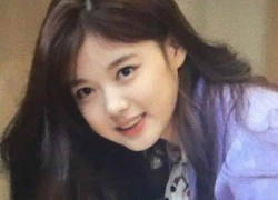 Bị sưng má, Kim Yoo Jung vẫn được khen xinh