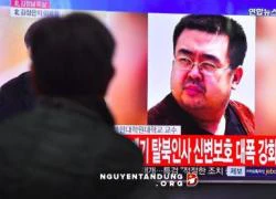 Anh ông Kim Jong-un đã nói những lời cuối nào trước khi chết?