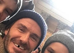 David Beckham gặp tai nạn, mất một răng cửa khiến fans xót xa