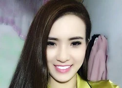 Em gái Công Vinh khoe ảnh cười rạng rỡ sau khi làm mới hàm răng