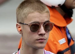 Justin Bieber bị cảnh sát điều tra vì tội ẩu đả