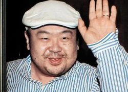 Ông Kim Jong-nam có thể thiệt mạng vì loại chất độc mới