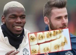 Pogba khoe niềng răng bằng vàng