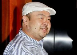 Tiết lộ thông tin ban đầu về khám nghiệm tử thi ông Kim Jong-nam