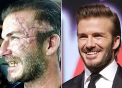 Becks gây sốc với mặt sẹo, răng ố vàng