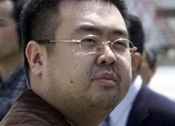 Malaysia hoàn tất khám nghiệm tử thi, xét nghiệm chất độc người nghi là Kim Jong-nam