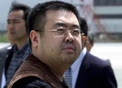 Ông Kim Jong-nam được nhận dạng bằng 21 nốt ruồi và hình xăm "độc"