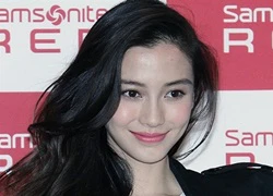 Bác sĩ của Angelababy bất ngờ tiết lộ sự thật, sau hơn một năm kiểm định phẫu thuật thẩm mỹ