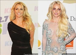 Chuyên gia nghi vấn Britney Spears dao kéo