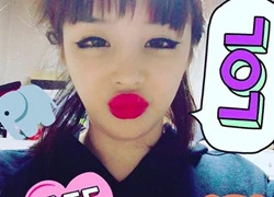 Park Bom nói gì khi khi fan khuyên ngừng 'dao kéo'