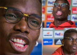 Pogba niềng răng để tránh vẩu như Ronaldinho