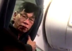 United Airlines đạt được thỏa thuận bồi thường bác sĩ David Dao