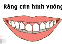 Cặp răng cửa 'tố' bản chất con người thực sự của bạn