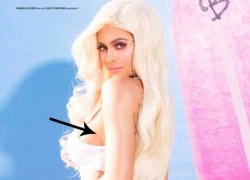 Hot girl Kylie Jenner thừa nhận phẫu thuật thẩm mỹ?