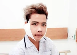 "Giật mình" vì nhan sắc của Tùng Sơn sau khi can thiệp "dao kéo"