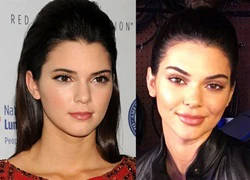 Sau nghi vấn bơm môi, Kendall Jenner đã xinh đẹp lại sexy thêm bội phần!