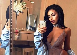 Mỹ nhân bị bạn trai kỳ thị vì phẫu thuật giống Kim Kardashian!