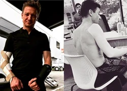 Ngôi sao &#8216;Avengers&#8217; Jeremy Renner gãy cả hai tay khi đóng phim