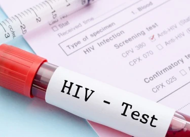 Lo sợ nhiễm HIV vì một lần trót lỡ